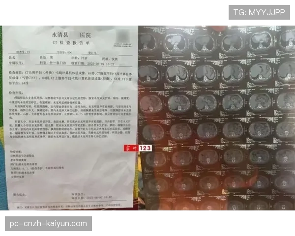 脑震荡后遗症：CTE的毁灭性检测，ct脑震荡的检查报告单